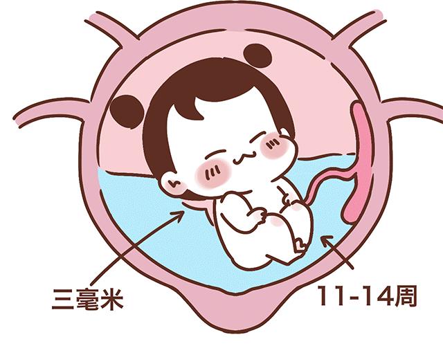 第139话 酱子的产检小知识-第138话
