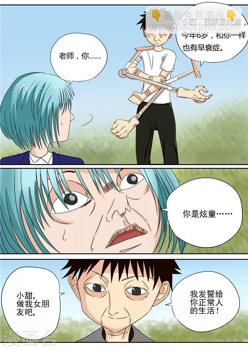 第14话 早衰症-第14话