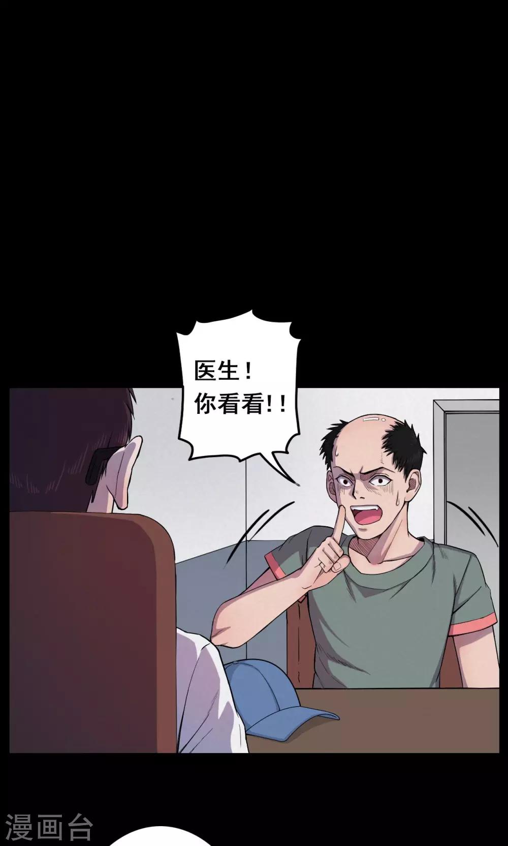 第16话 植发1-第16话