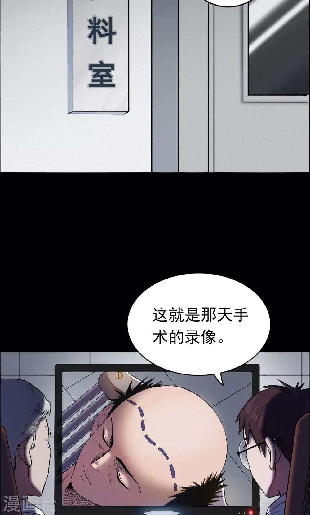 第18话 植发3-第18话