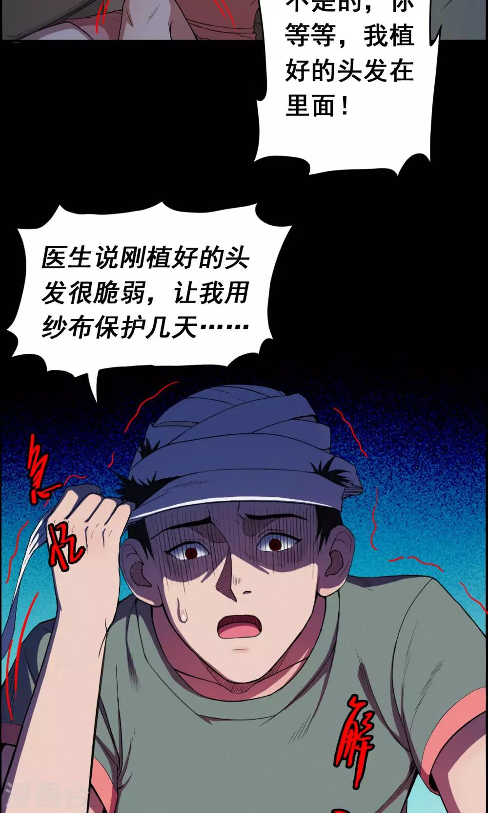 第18话 植发3-第18话