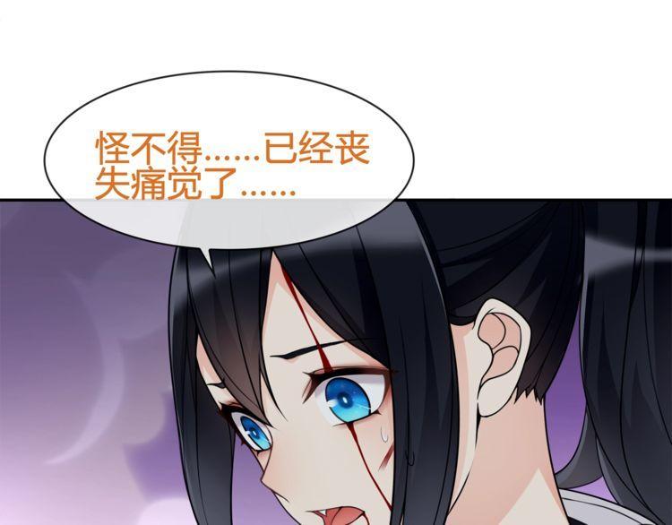 第86话 致命伤口？(1/2)-第90话