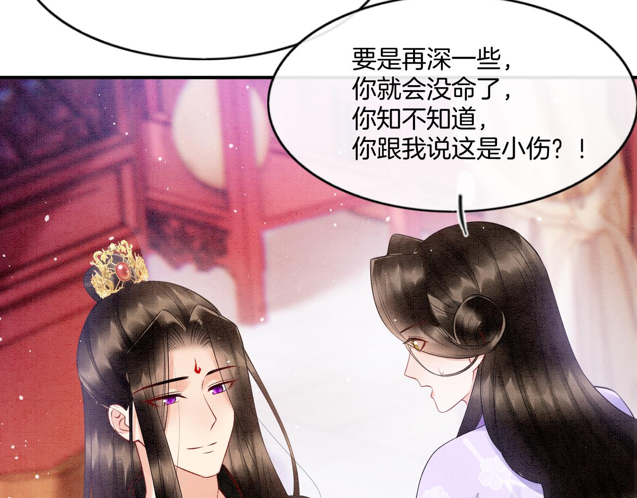 第64话 本宫给皇上上药(1/3)-第64话