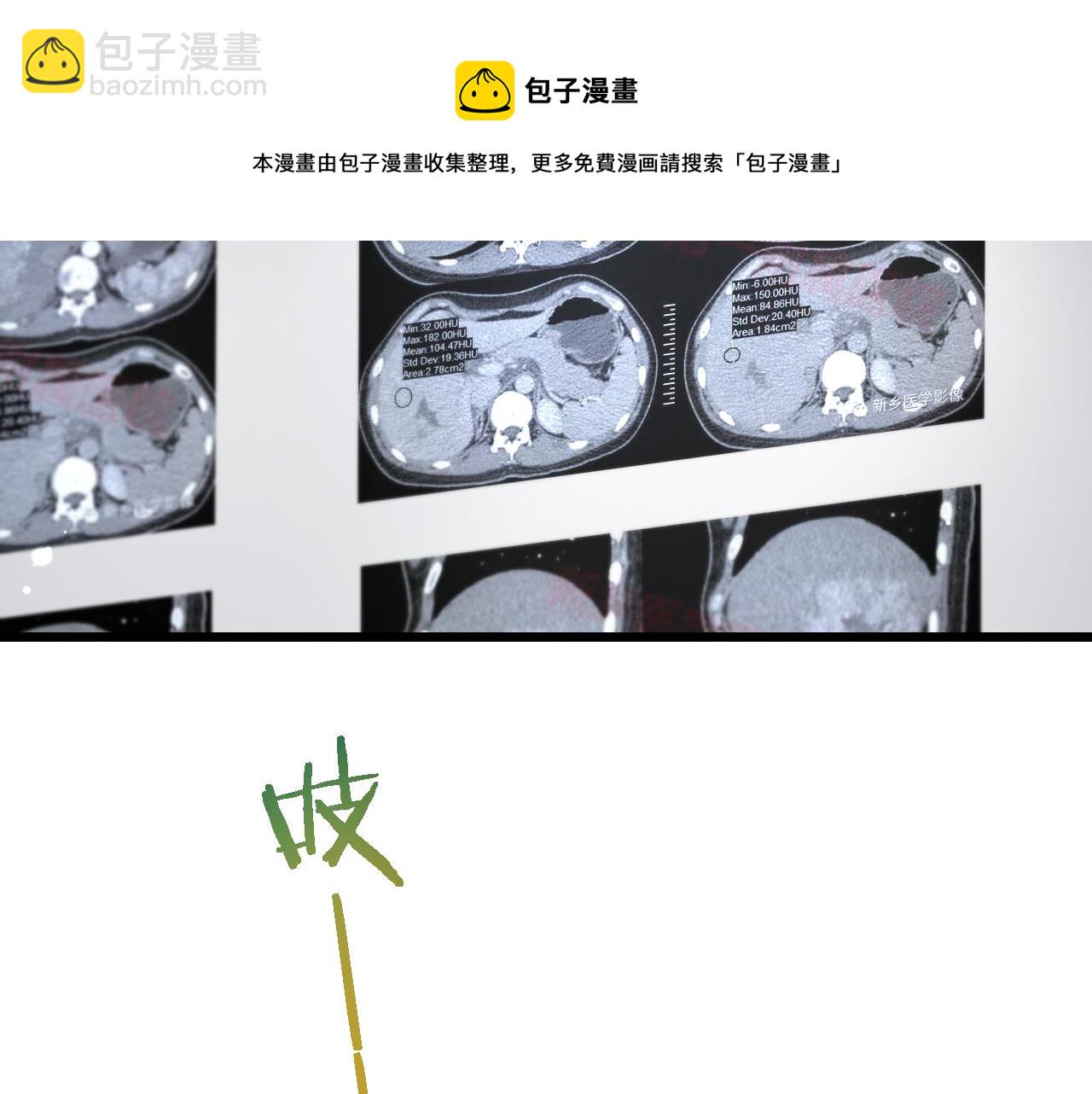 🍼大医凌然 第177话 规则，用强大碾平 第50页