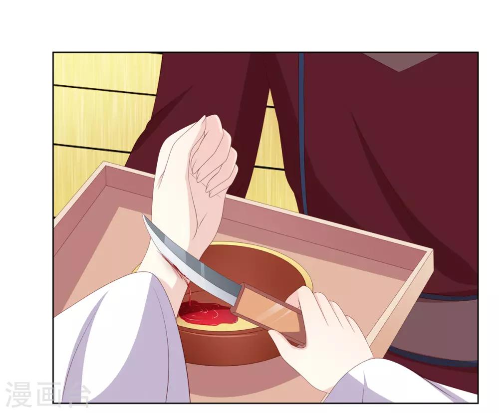 第2季35话 引血化毒-第70话