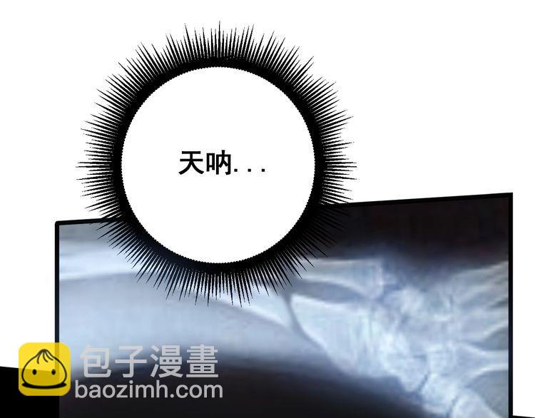 毒手巫醫 - 第143話 凱氏骨病(3/4) - 6