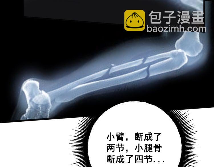 毒手巫醫 - 第143話 凱氏骨病(3/4) - 7