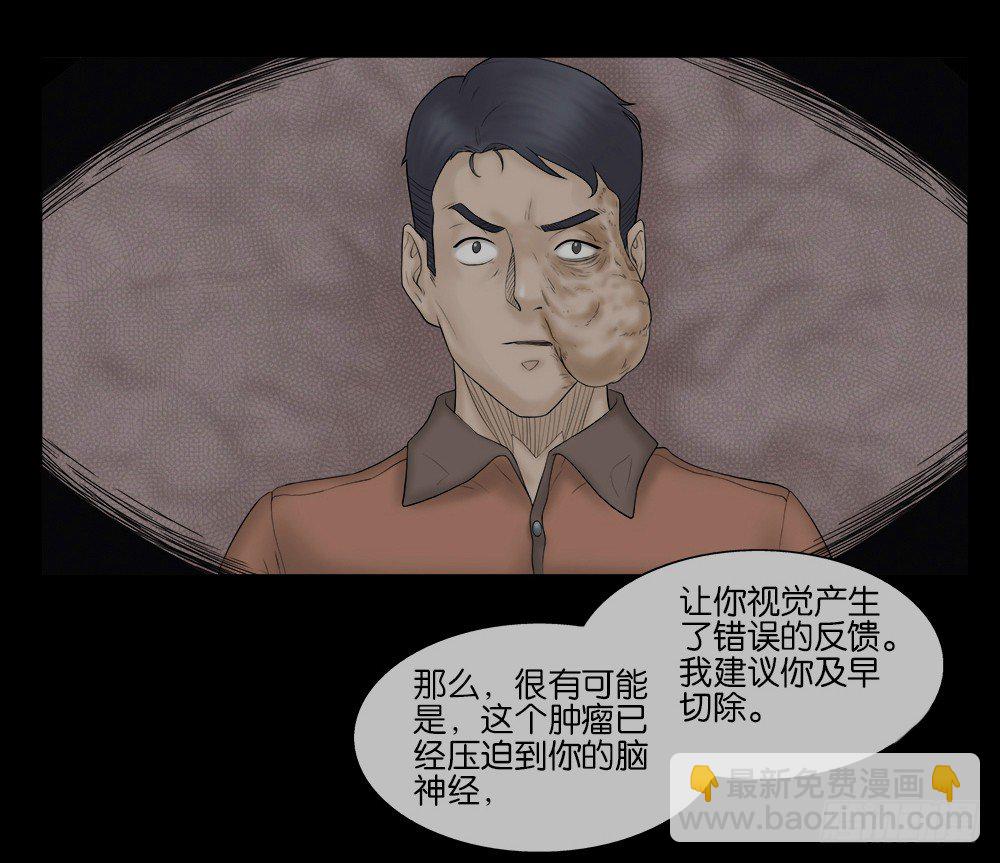 🍸怪奇笔记（怪奇脑洞集） 奇异的瘤 第35页