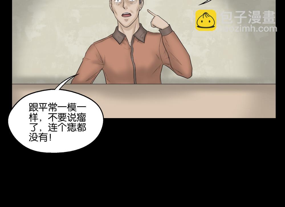 🍸怪奇笔记 奇异的瘤 第44页