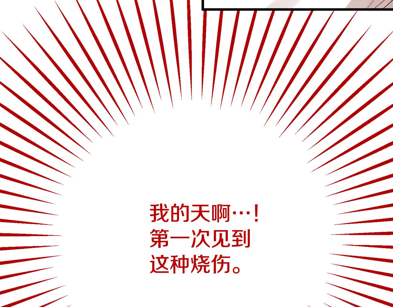 第34话 泽尔突然烧伤(1/4)-第34话