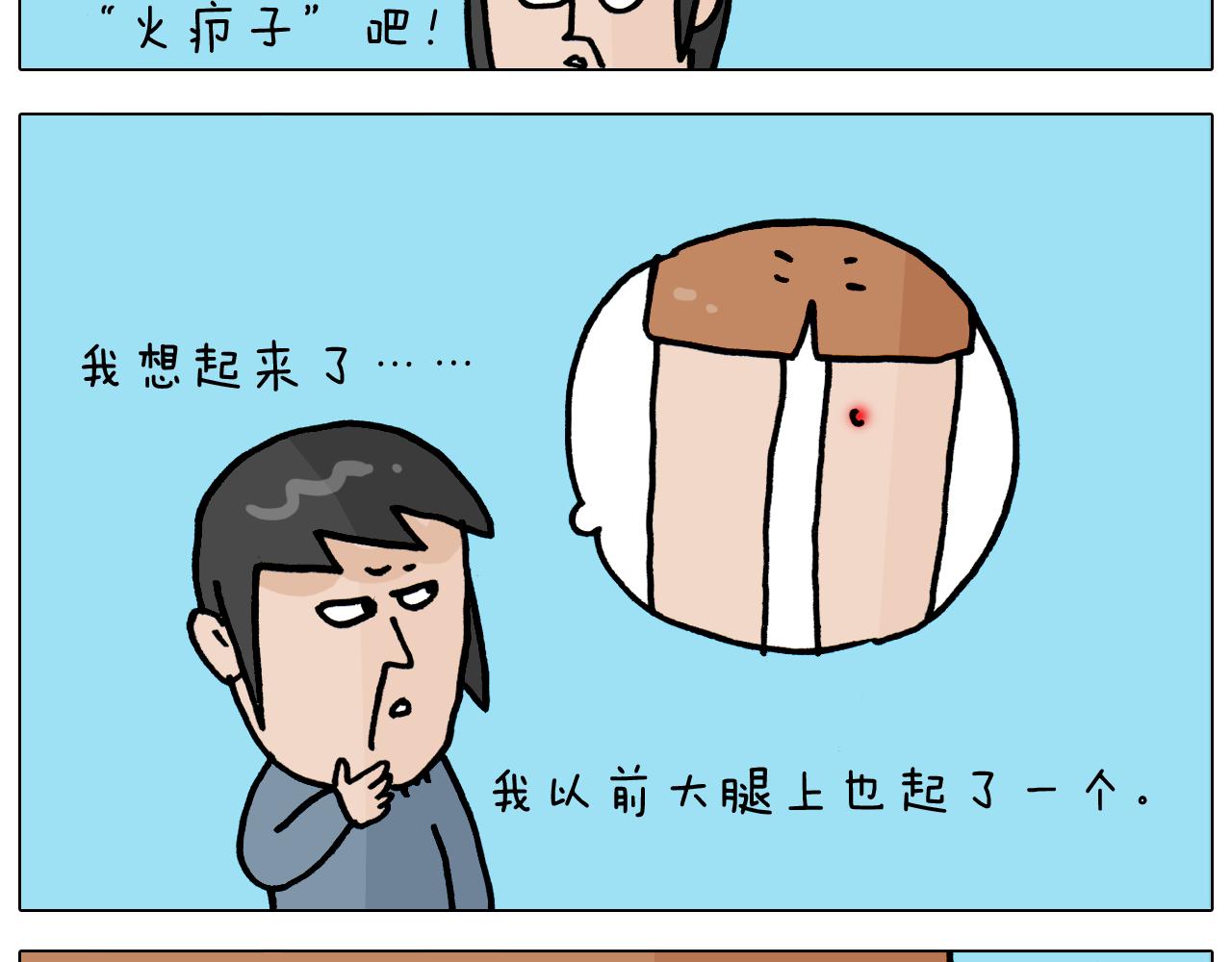 第361话 火疖子(1/2)-第360话