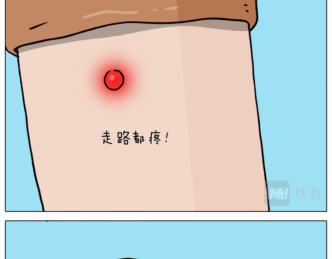 第361话 火疖子(1/2)-第360话