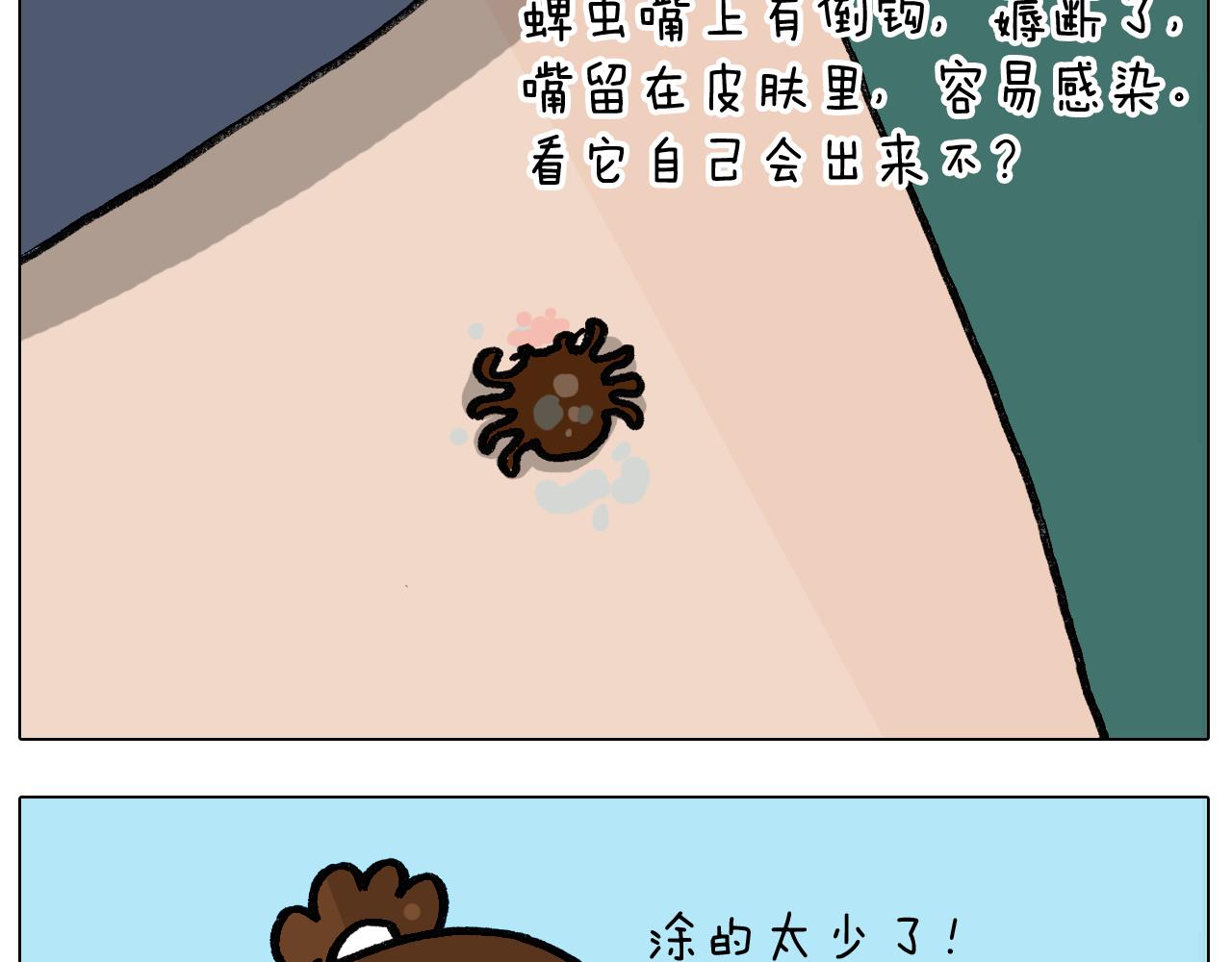 第399话 吸血虫(1/2)-第398话