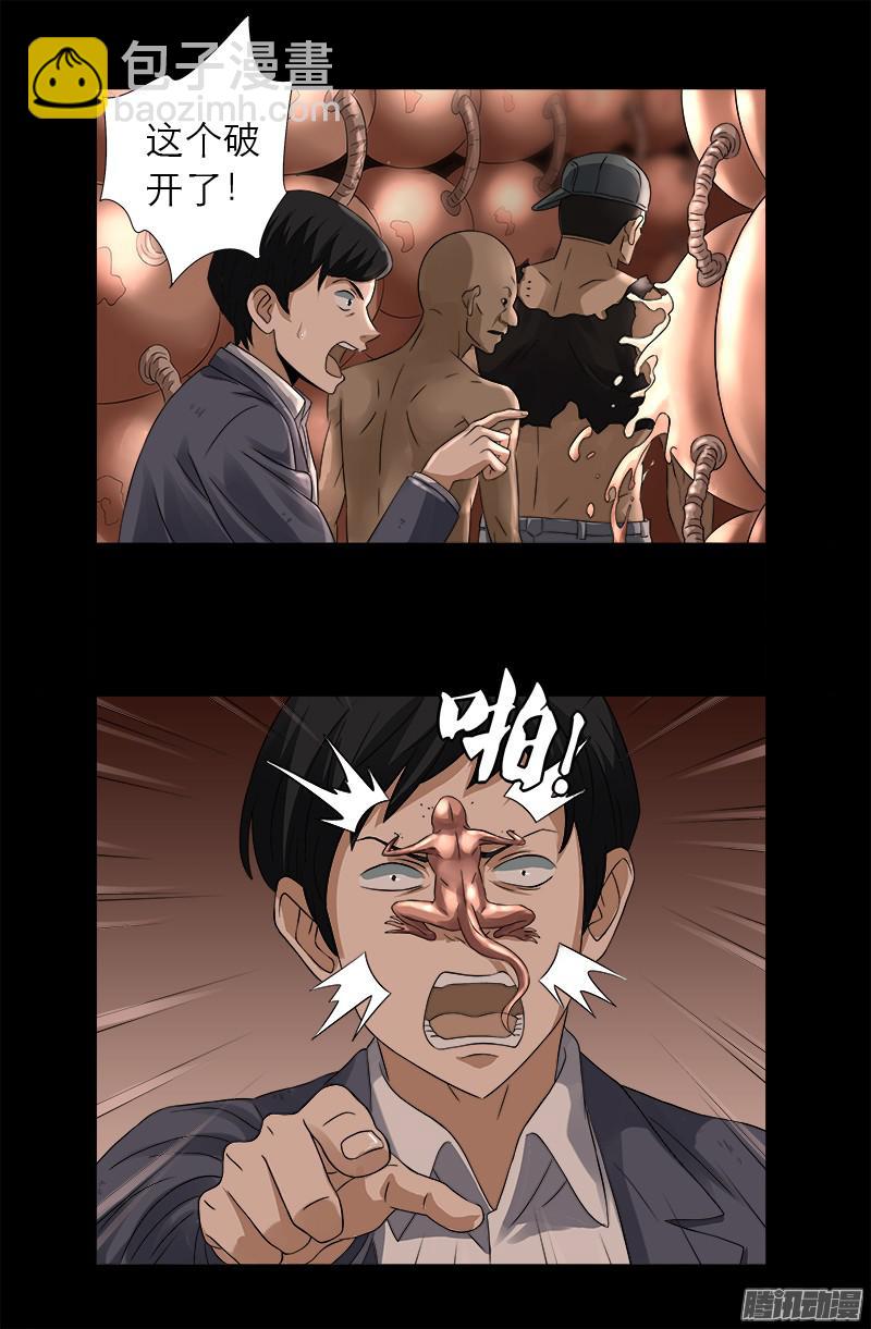 第297话 小脑萎缩-第292话