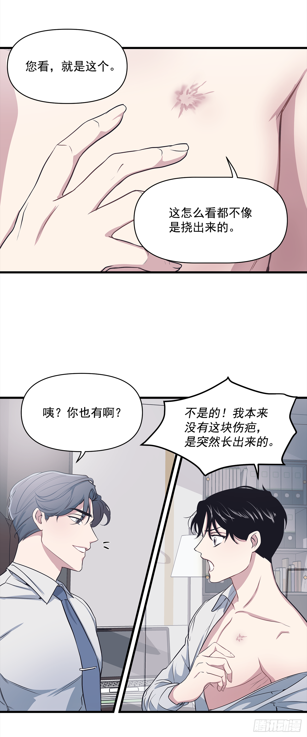 3.伤疤(1/2)-第4话