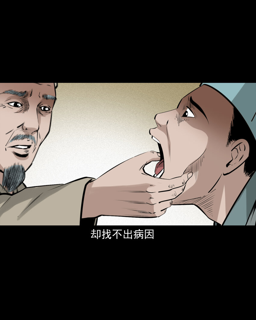 74 第74话拔舌之症-第74话