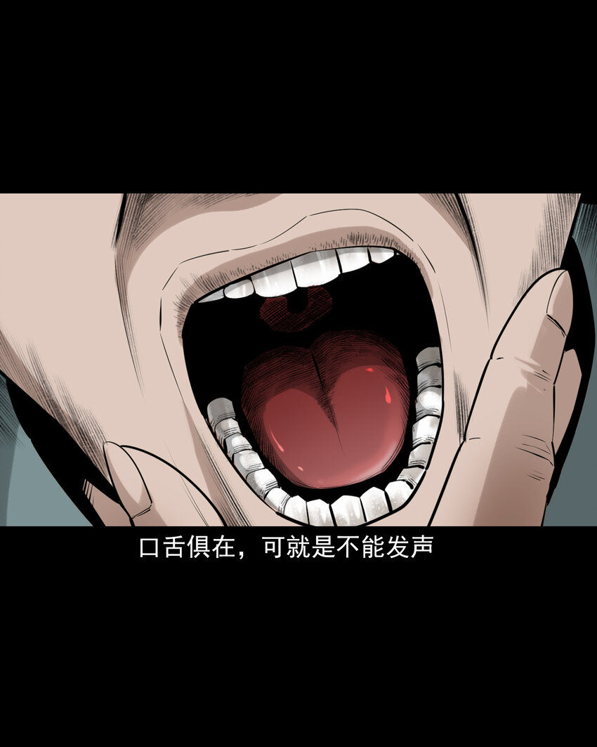74 第74话拔舌之症-第74话