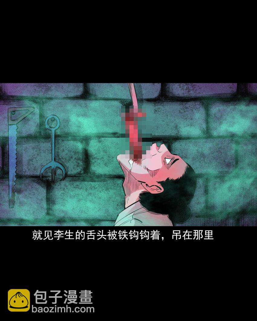 74 第74话拔舌之症-第74话