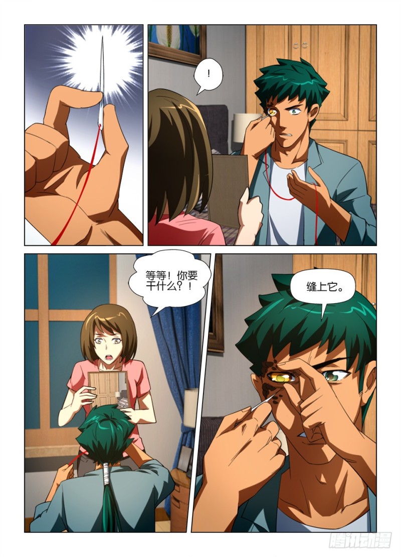第178回 缝眼-第178话