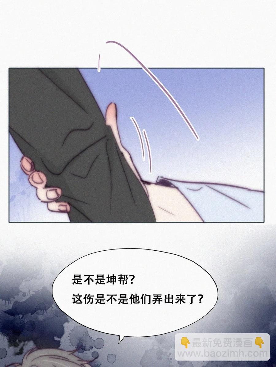 第144话 瞿城受伤(1/2)-第150话