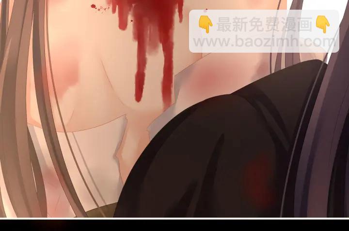 第185话 命悬一线(1/3)-第194话