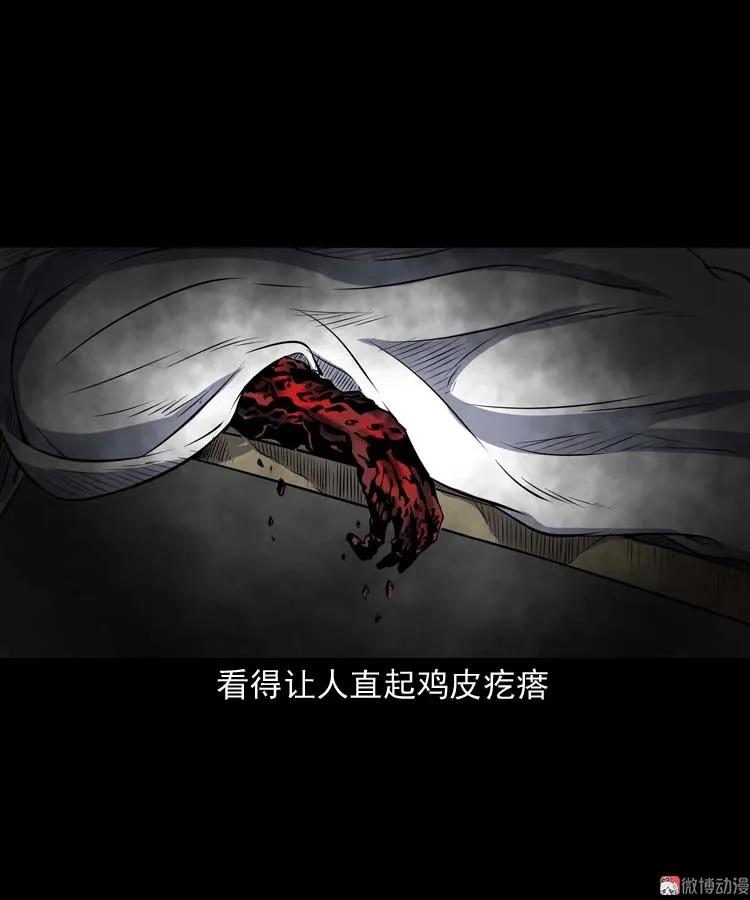 火刑(1/2)-第172话