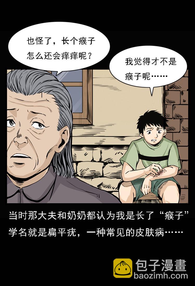 疯乞丐(1/2)-第32话