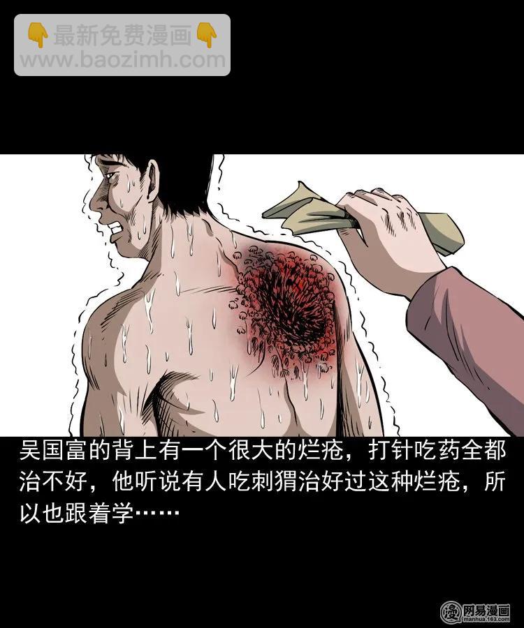 168 刺猬(1/2)-第170话