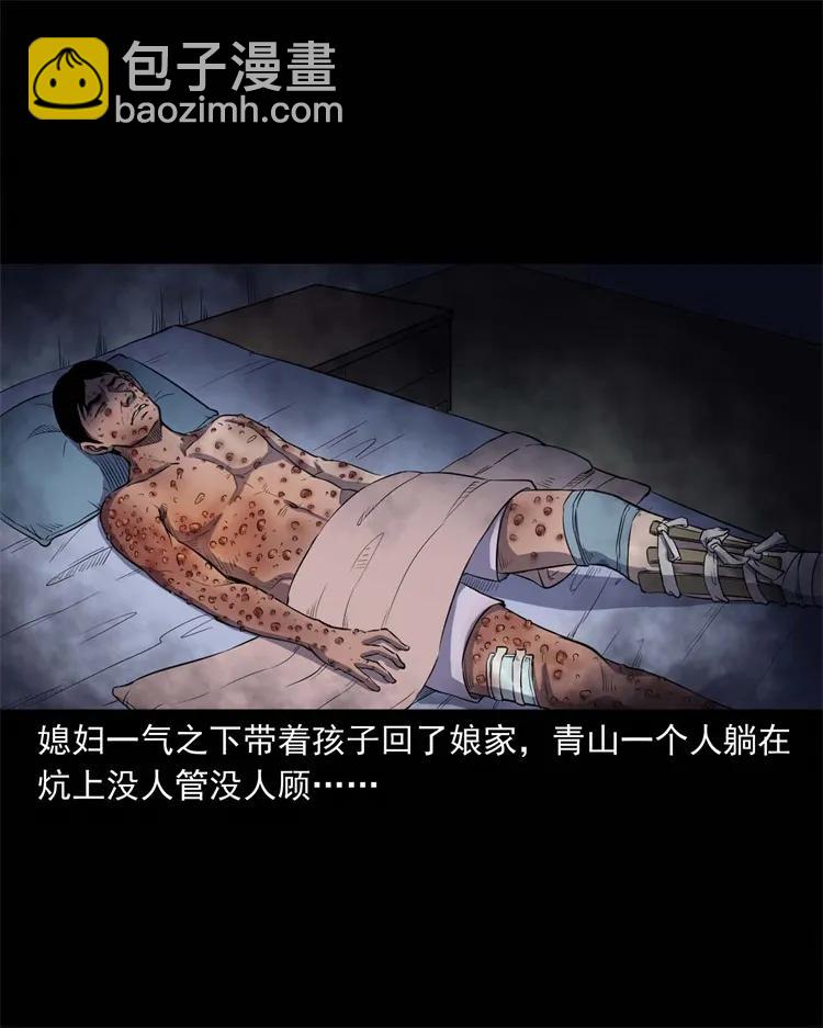 254 瘟神-第256话