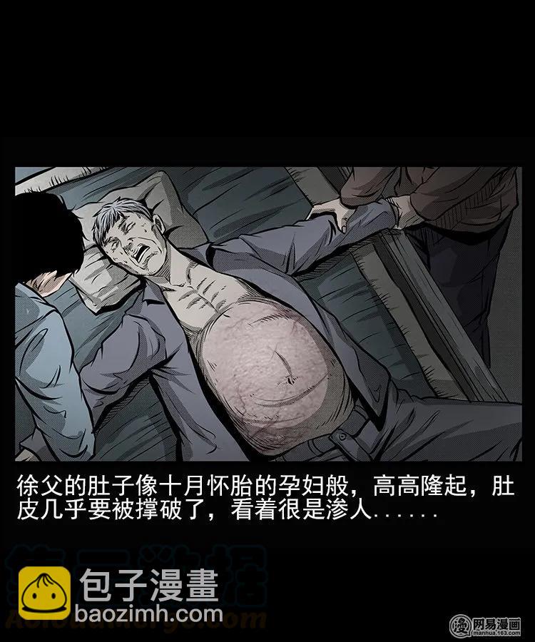 66 赤脚医生破蛊（上）(1/2)-第66话
