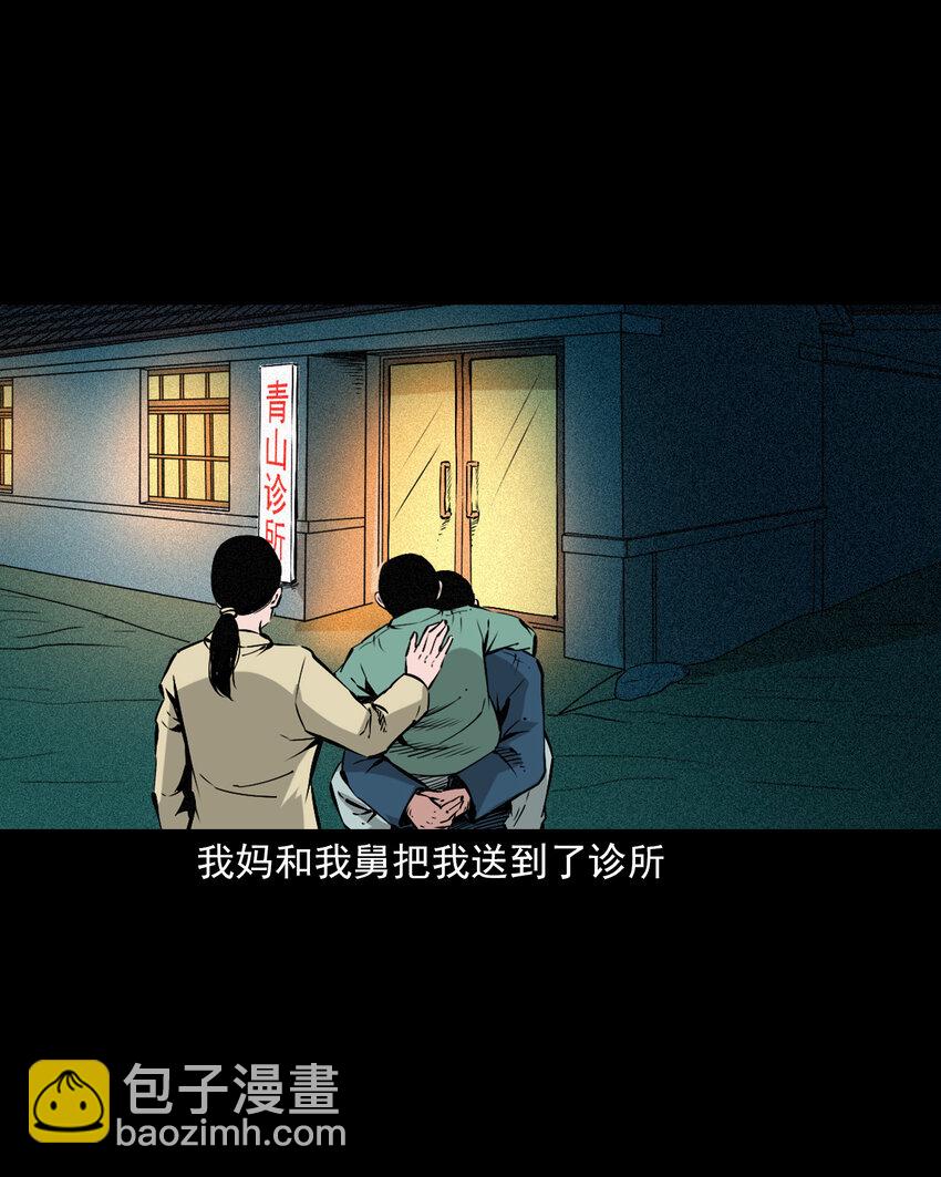 654 井里的大花脸-第654话