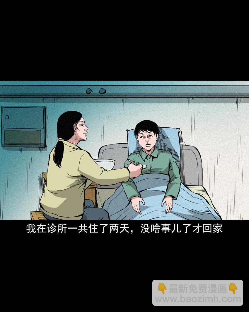 654 井里的大花脸-第654话
