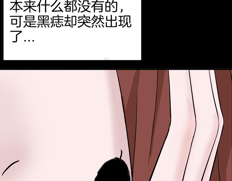 第44话 痣(1/5)-第44话