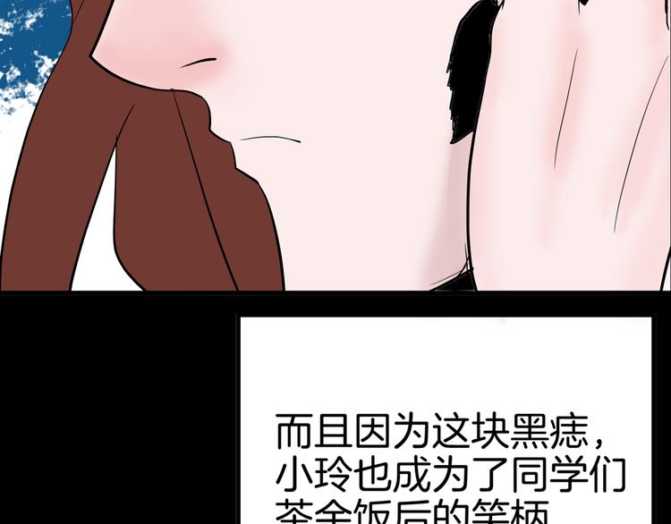 第44话 痣(1/5)-第44话