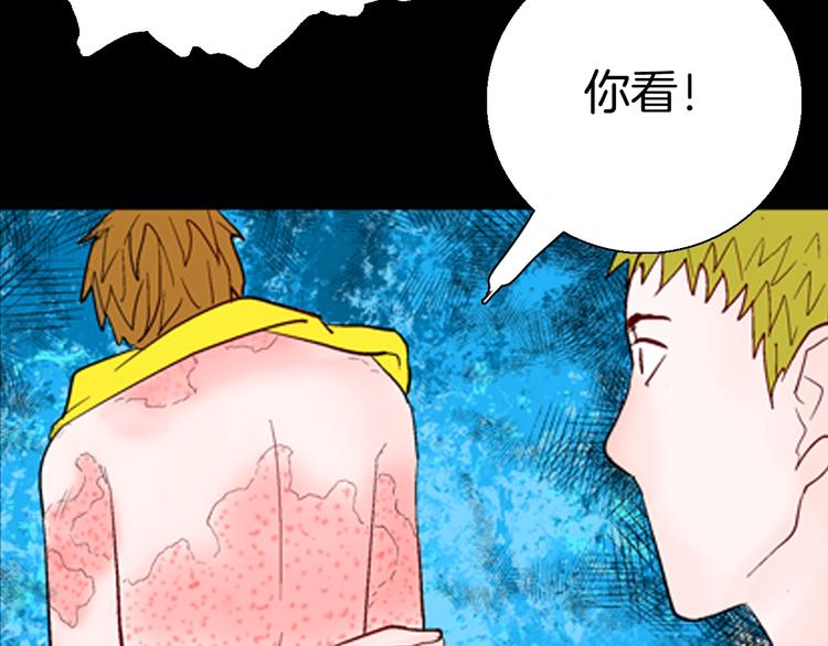 第92话 皮肤病患者(1/3)-第94话