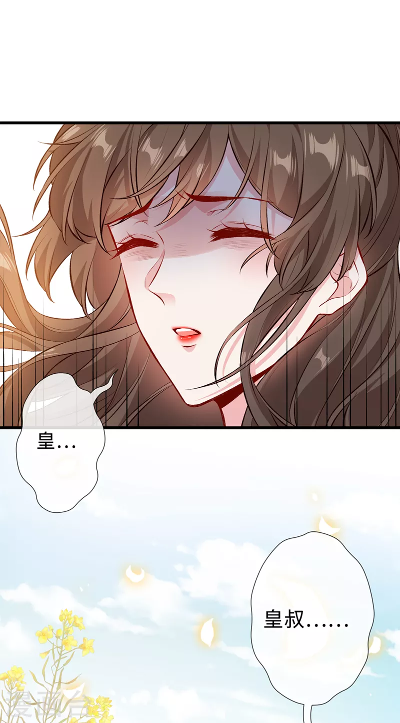 第127话 皇叔&hellip;头好疼-第130话