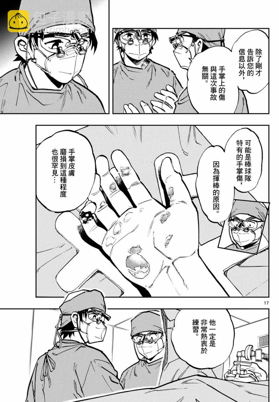 🍱手外科 第02话 第17页