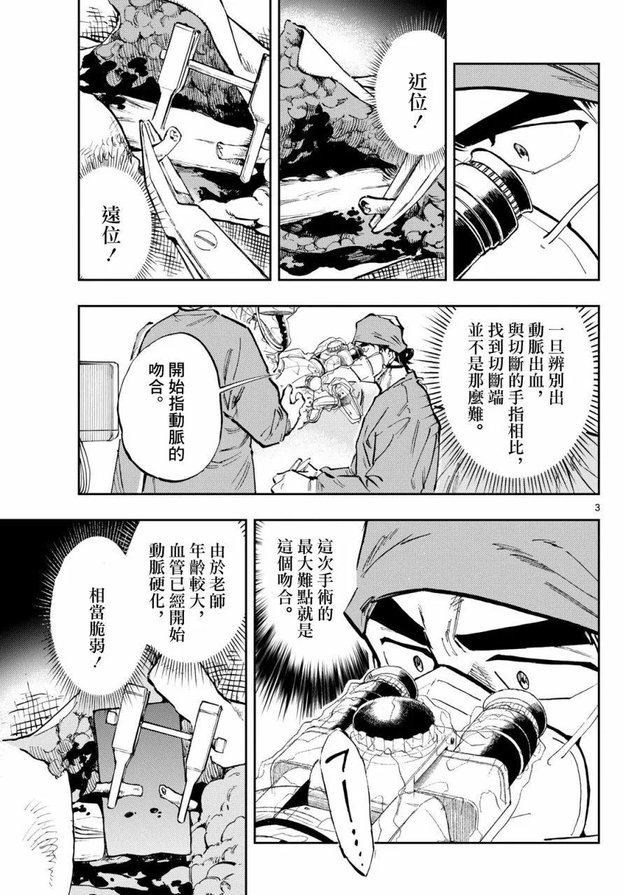 🍱手外科 第28话 第3页