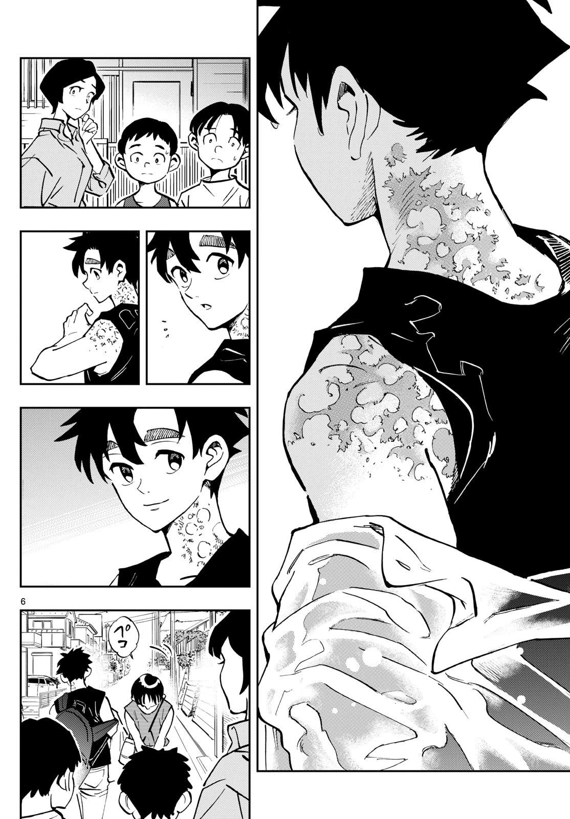 🍱手外科 第44话 第6页