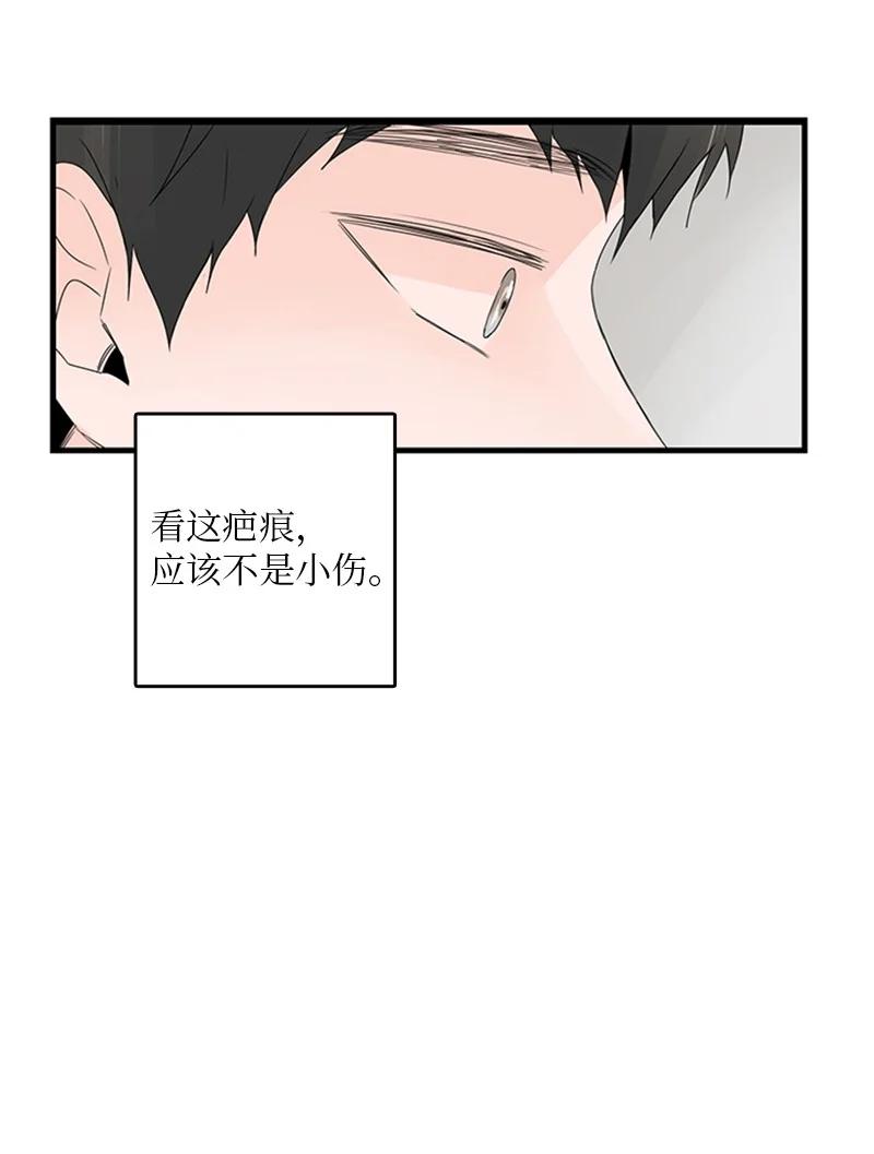 17 是因为那个伤疤吗？(1/2)-第18话