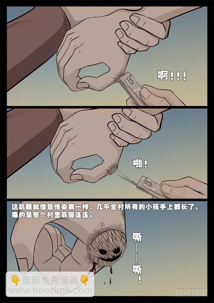 冤魂疮 01-第472话