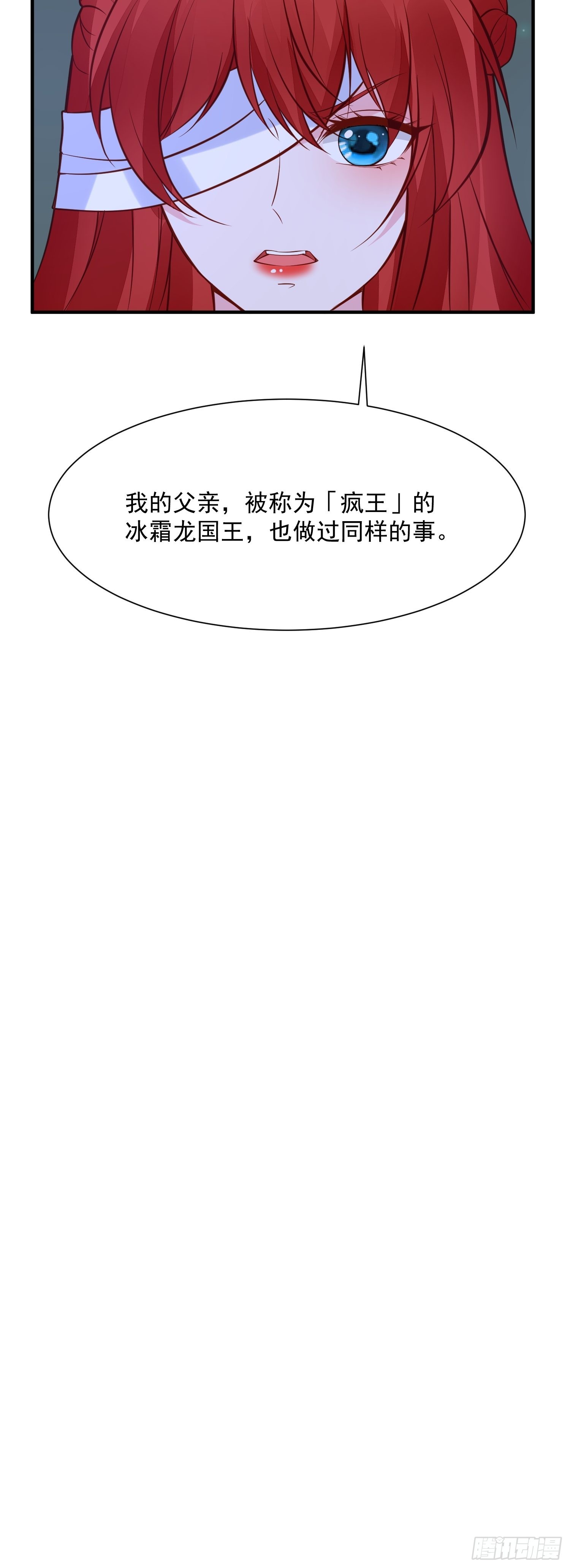 第91话 眼睛的代价-第94话
