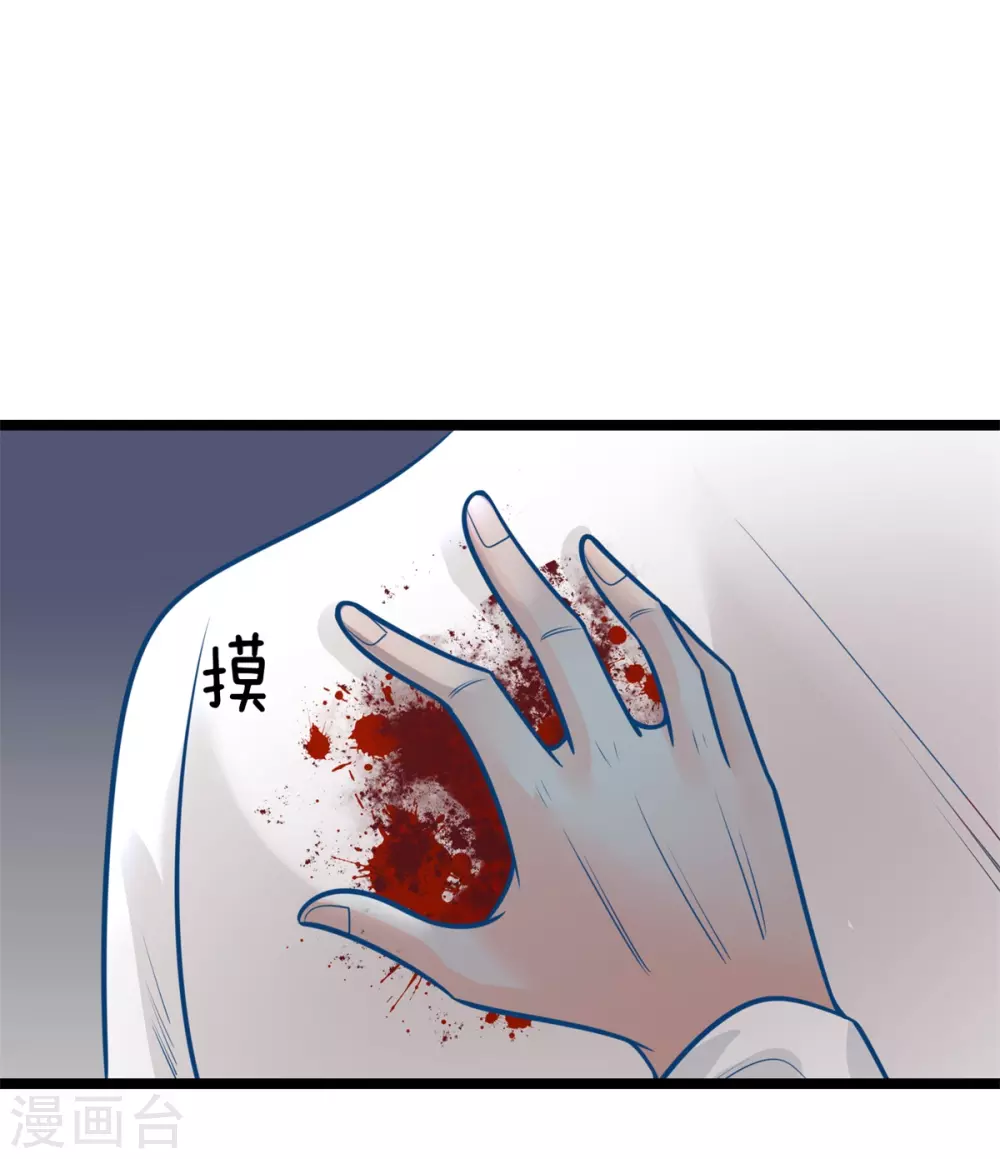 第161话 受伤，咱俩不熟-第172话