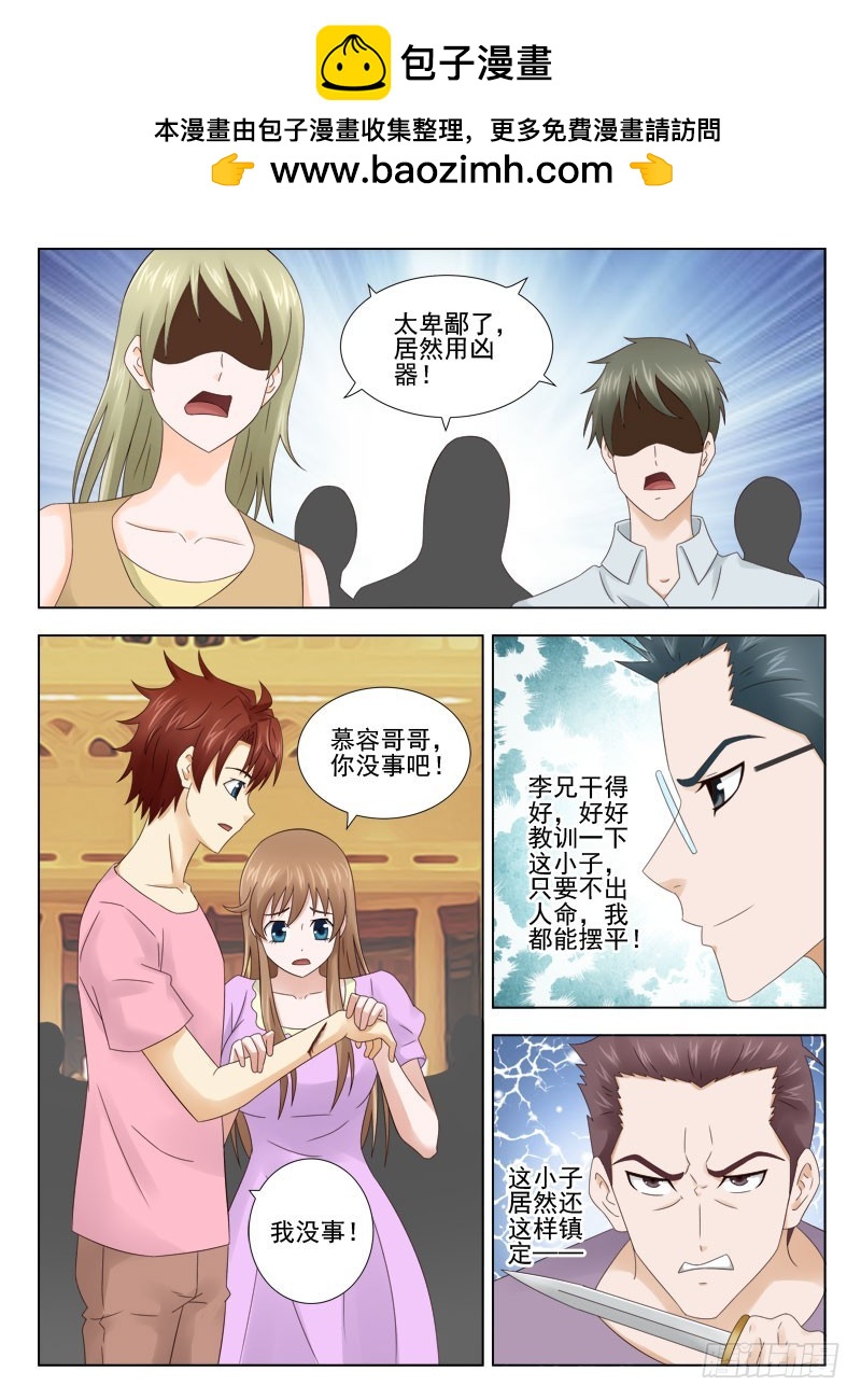 163 受伤-第166话